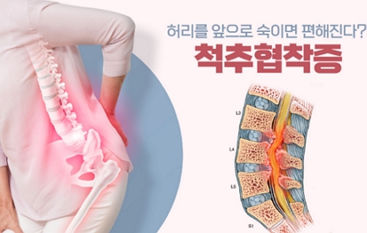 제공= 힘찬병원