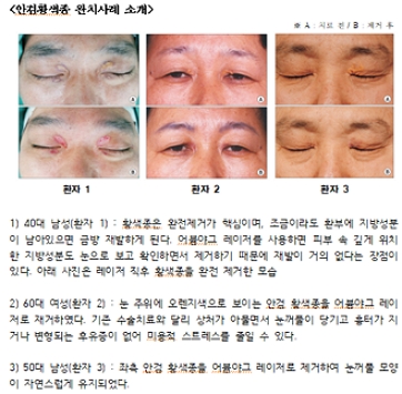 제공=고려대안암병원