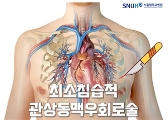 최소침습적 관상동맥우회로술/제공=서울대병원