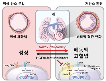 Sox17 유전자가 결핍되고 저산소 환경에 노출되면 폐동맥 고혈압의 발생 위험이 높다./제공=서울대병원