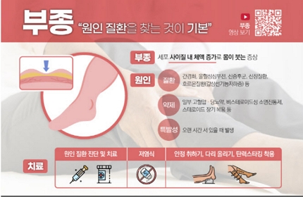 제공=에이치플러스 양지병원