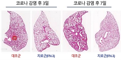 폐 조직분석 결과(염증 부위 분홍색). 인터페론 람다를 비강 흡입한 코로나 감염 동물 모델은 대조군에 비해 폐 조직의 염증이 덜했다./제공=서울대병원