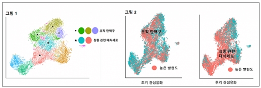 간섬유화 단계에 따른 단핵세포 발현 영상으로 그림 1은 면역단백 발현 양상에 따른 단핵세포들의 상대적 위치를 나타낸 지도. 조직 단핵구는 원(∙), 상흔 관련 대식세포는 별(★)로 표시돼 있다. 그림 2는 단백질 발현 결과에 따른 단핵세포 발현 양상으로 그림 1과 비교·대입해 보았을 때 초기 간섬유화에서는 조직 단핵구가, 후기 간섬유화에서는 상흔관련 대식세포의 발현도가 높음을 확인할 수 있다./제공=은평성모병원