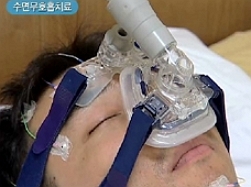 수면무호흡증/제공=서울아산병원