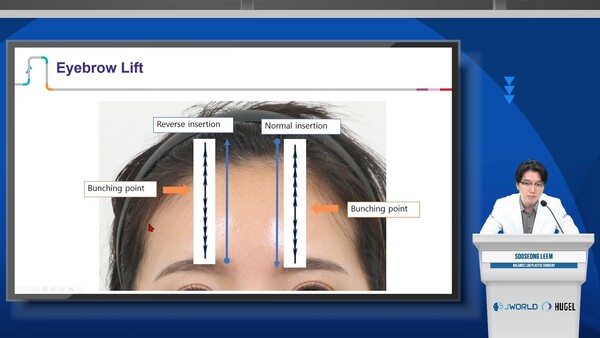 임수성 밸런스랩성형외과 원장 강의. /휴젤 제공