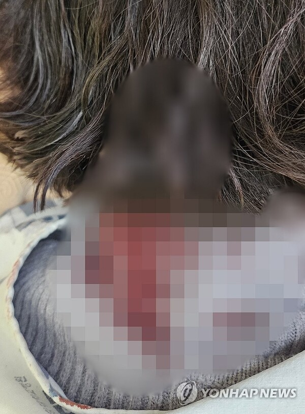  배현진 의원 피습 직후 촬영된 사진. 회색 니트의 목주변에 다량의 혈흔이 묻어 있다. /배현진 의원실
