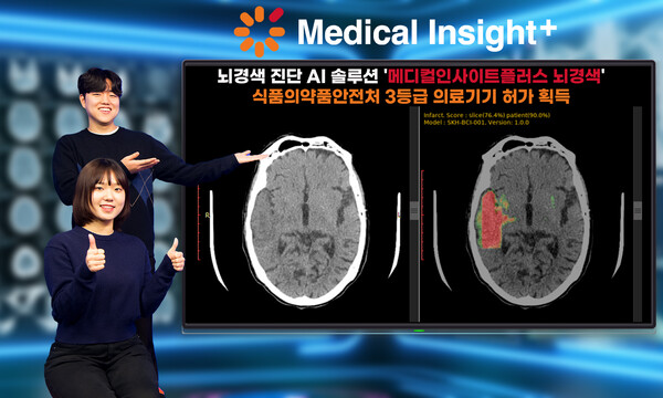 SK C&C가 개발한 뇌경색 진단 AI솔루션 '메디컬인사이트플러스 뇌경색'이 식품의약품안전처로부터 3등급 의료기기 허가를 받았다. / SK C&C