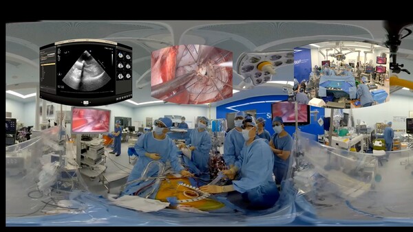 폐암수술 교육 위한 현장강의. /분당서울대병원 제공