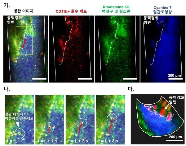 심박 동기화 움직임 보상 기법을 통해 획득한 동맥경화 병변 쥐 경동맥 영상. /KAIST 제공
