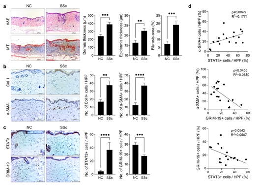 전신경화증 질환 피부에서 섬유화 지표들과 ‘GRIM-19’ 단백질 발현 상관성 조사./가톨릭중앙의료원 제공