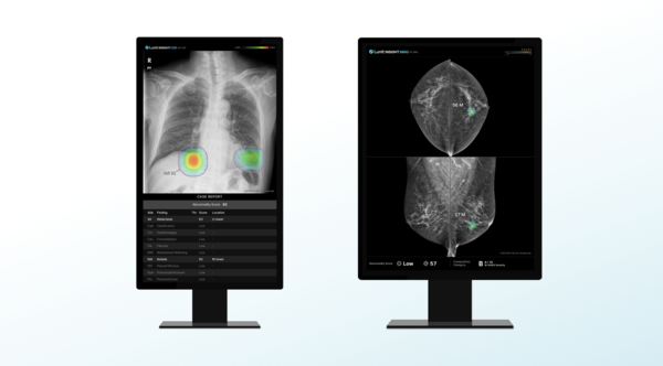 루닛 흉부 엑스레이 AI 영상분석 솔루션 '루닛 인사이트 CXR'(왼쪽)과 유방촬영술 AI 영상분석 솔루션 '루닛 인사이트 MMG' . /루닛 제공