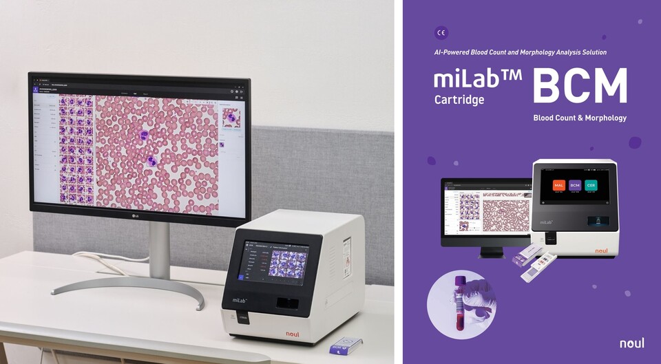 AI 혈액 분석 솔루션 'miLab BCM'. /노을 제공