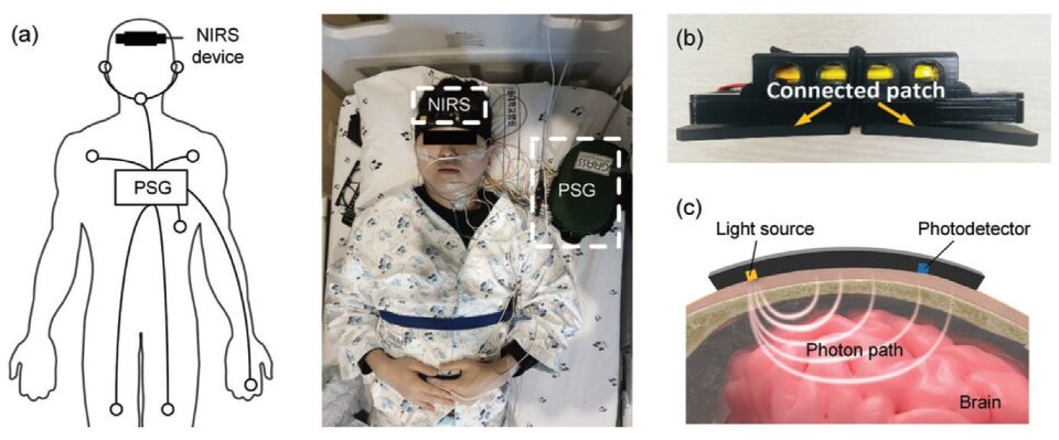 분당서울대병원 신경과 윤창호 교수와 KAIST 전기·전자공학부 배현민 교수 공동 연구팀이 개발한 무선 근적외선 분광기./분당서울대병원 제공