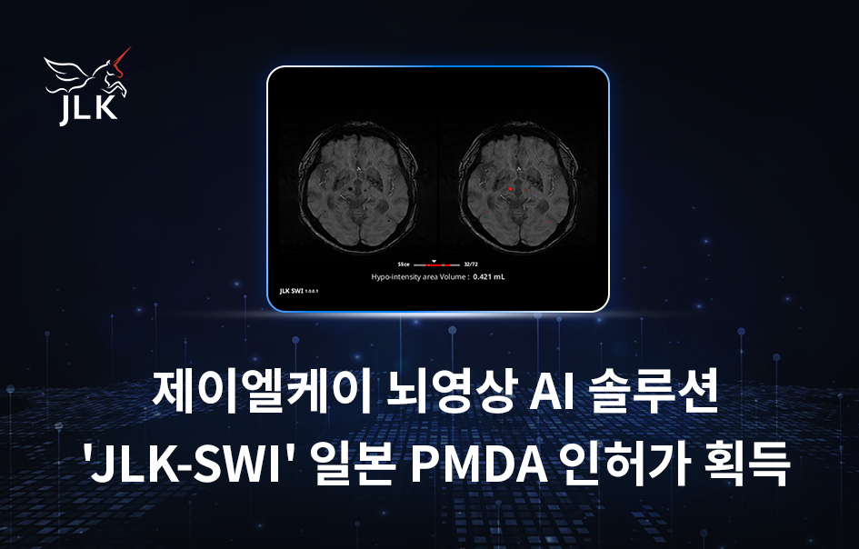 제이엘케이가 뇌영상 AI ‘JLK-SWI’의 일본 PMDA 인허가를 획득했다./제이엘케이 제공