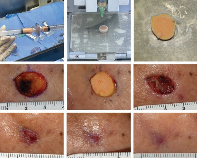 로킷헬스케어는 10일(현지시각)부터 오는 12일까지 미국 루이지애나 뉴올리언스에서 열리는 세계 최고 권위의 성형외과 학회 ‘Plastic Surgery the Meeting(PSTM)’에서 AI 기반 피부암 재생 플랫폼을 공식 공개한다. /로킷헬스케어 제공