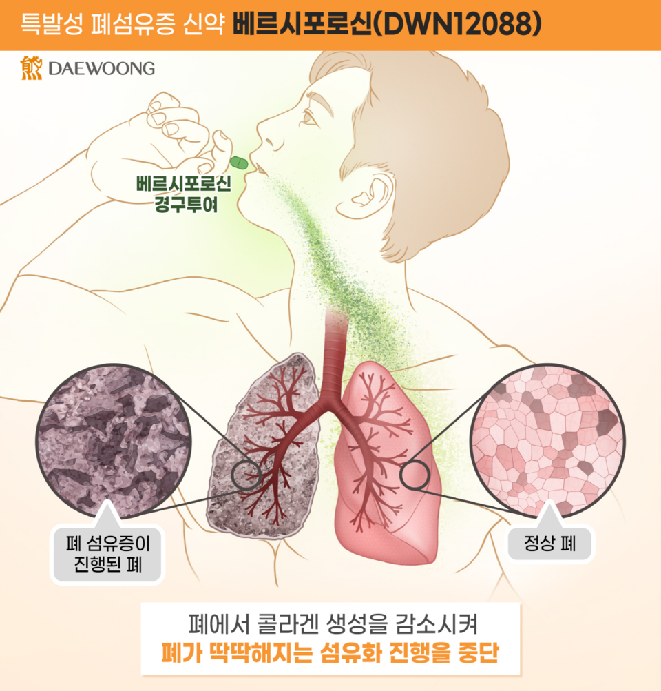 대웅제약 베르시포로신(DWN12088) 작용 기전. /대웅제약 제공