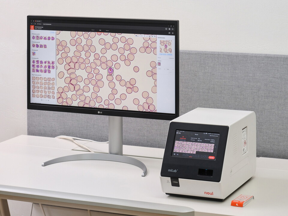 AI 기반 말라리아 진단 솔루션 '마이랩(miLab MAL)'. /노을 제공