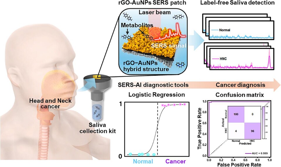 비침습적 두경부암 진단 플랫폼 개요도./서울성모병원 제공