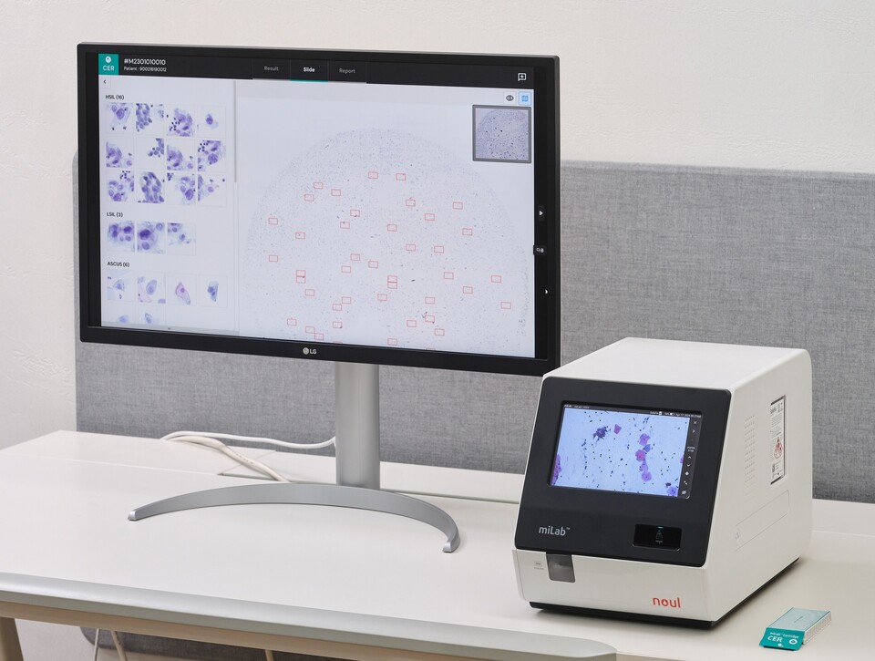 AI 기반 자궁경부암 진단 솔루션(miLab CER). /노을 제공